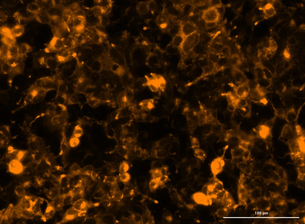 HEK293T cells overexpressing TMEM175 stained with ION Biosciences’ 6-TMR HaloTag.
