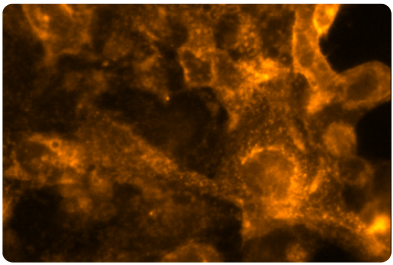 Fluorescence image showing ION Thallos Gold-HTL localized to lysosomes inside of viable cells.