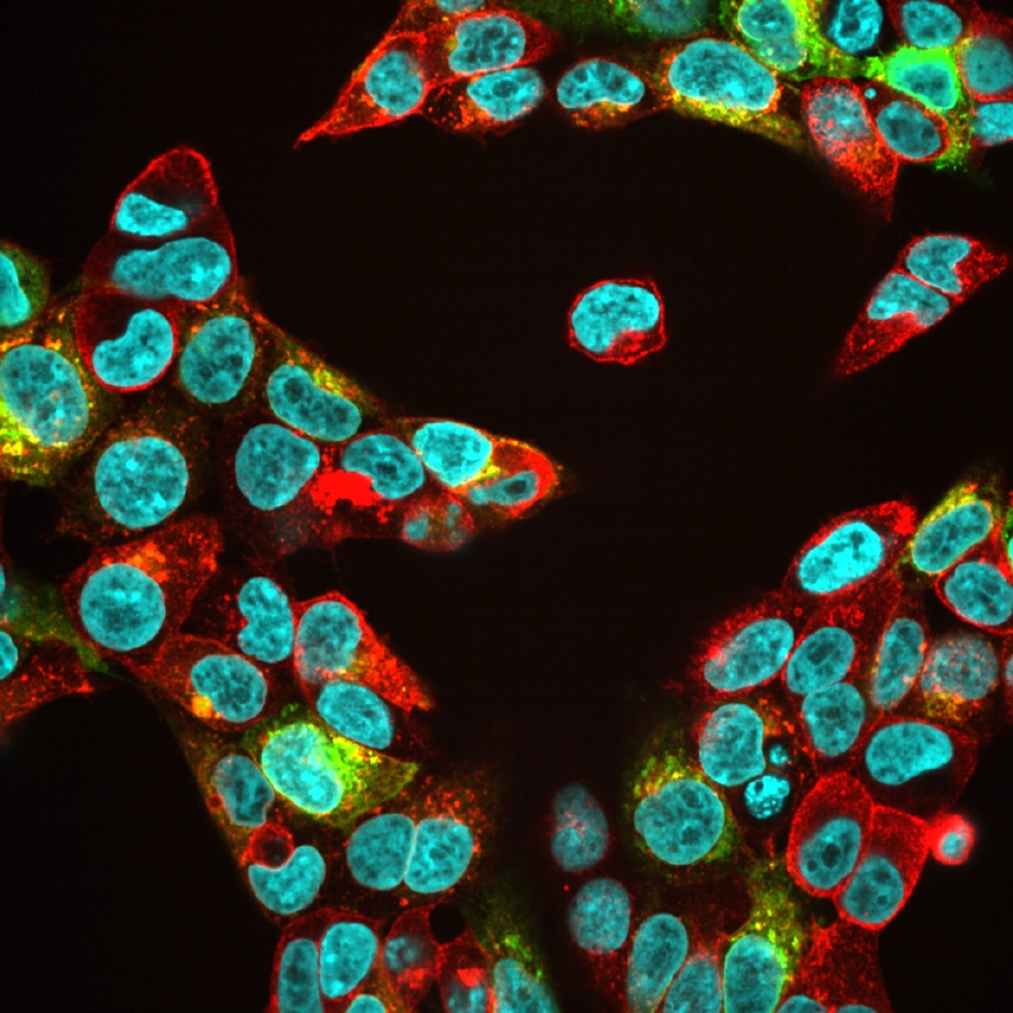 OG488-HTL (in green) localized in lysosomes expressing HaloTag®, multiplexed with 6-TMR-HTL (red). Cells were treated with the TMEM175 activator DCPIB and imaged every 30 minutes for 5 hours on a Cytation 5
