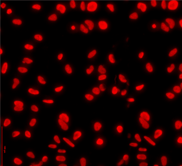 Fluorescence image of dead cells whose nuclei are stained red by ethidium homodimer